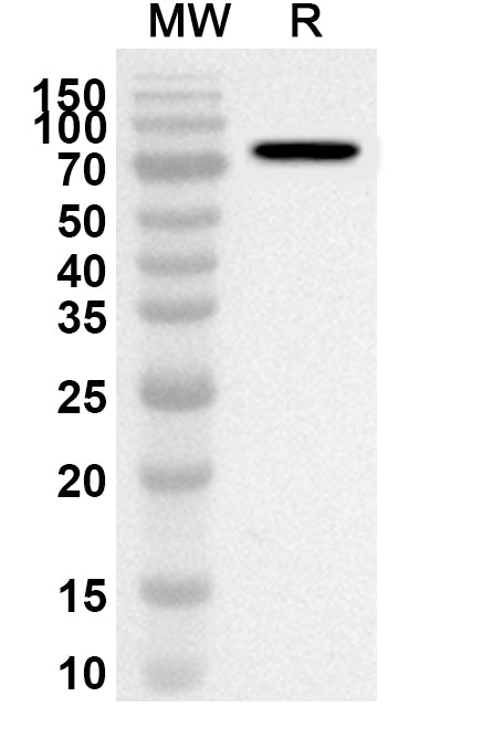 Western blot analysis was performed using anti-HPV18 L1/Major capsid protein L1 polyclonal antibody at 1ug/mL on recombinant HPV18 L1/Major capsid protein L1 (Catalog No. VK639012).