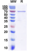 Recombinant CHIKV NSP2 Protein, N-GST-His