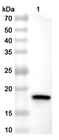 Western blot analysis was performed using anti-NPS3-CHPV  polyclonal antibody at 1ug/mL on various samples.
Lane 1: recombinant CHIKV NSPS3 (Catalog No: VK640032)