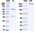 SDS-PAGE for InVivoMAb Anti-Hantaan virus Glycoprotein C/Gc Broad-Neutralizing Antibody (Iv0260)