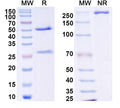SDS-PAGE for Anti-DENV-2 NSP5/NS5 Antibody (4A1)