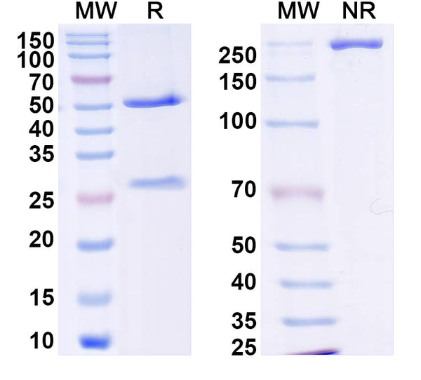SDS-PAGE for Anti-DENV-2 NSP5/NS5 Antibody (1D8)