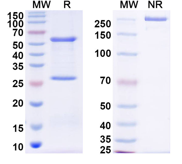 SDS-PAGE for Anti-DENV-2 NSP5/NS5 Antibody (1D7)