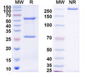 SDS-PAGE for Anti-DENV-2 NSP5/NS5 Antibody (3B4)
