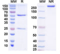 SDS-PAGE for Anti-DENV-2 NSP5/NS5 Antibody (2E3#)