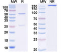 SDS-PAGE for Anti-Zika virus/ZIKV NS1c Antibody (DV62.5).