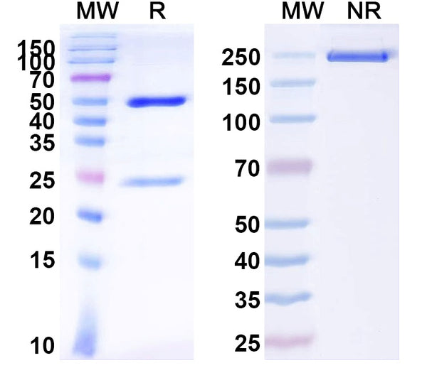 SDS-PAGE for Anti-Foot-and-mouth disease virus/FMDV 3ABC/3B Antibody (FM27).