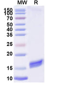 SDS-PAGE for Anti-Bacteriophage H19B stxB/SLT-1b/VT1 Nanobody (7-2#)