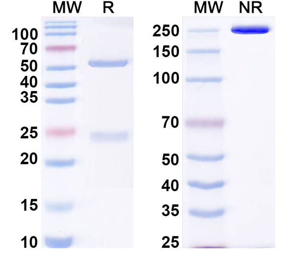 SDS-PAGE for Anti-HHV-5/HCMV gB/Envelope glycoprotein B Antibody (F3c10)