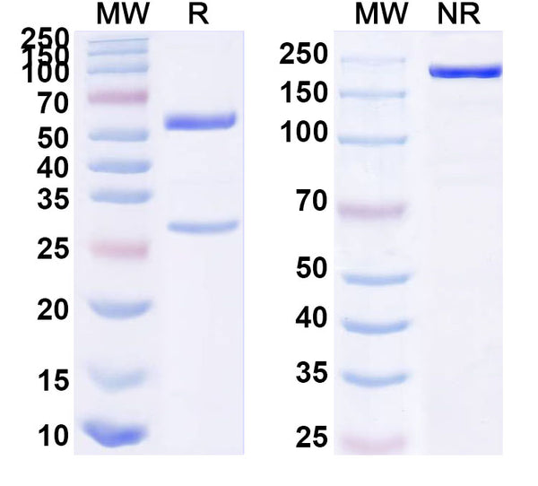 SDS-PAGE for Anti-HHV-5/HCMV gB/Envelope glycoprotein B Antibody (3-15#)