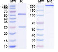 SDS-PAGE for Anti-HHV-5/HCMV gB/Envelope glycoprotein B Antibody (1B03)