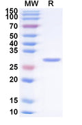 SDS-PAGE gel with protein markers and a sample showing molecular weight bands.