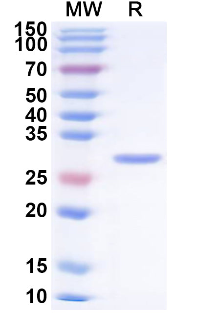SDS-PAGE gel with protein markers and a sample showing molecular weight bands.