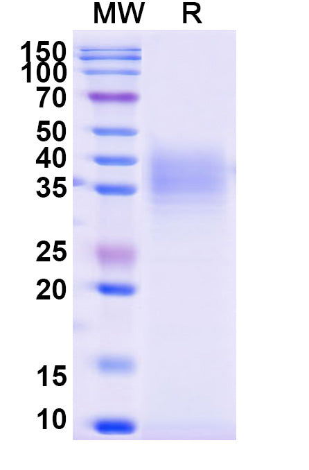 Recombinant Monkeypox virus/MPXV E8L Protein, C-His
