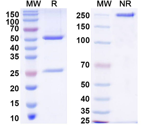 SDS-PAGE for InVivoMAb Anti-HCV NS1/gp68/gp70/Envelope glycoprotein E2 Antibody (RM2-01)
