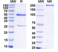 SDS-PAGE for Anti-HCV NS1/gp68/gp70/Envelope glycoprotein E2 Antibody (HC33.4)