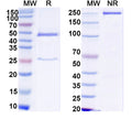 SDS-PAGE for Anti-HCV NS1/gp68/gp70/Envelope glycoprotein E2 Antibody (HC33.8)