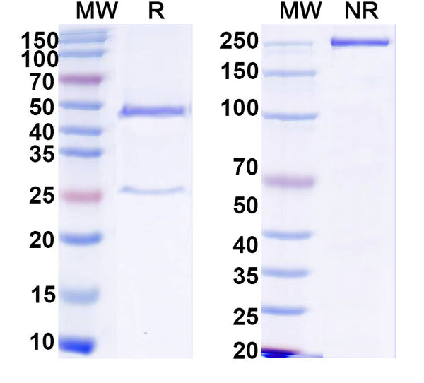 SDS-PAGE for Anti-HCV NS1/gp68/gp70/Envelope glycoprotein E2 Antibody (HC84-1)