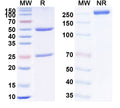 SDS-PAGE for InVivoMAb Anti-HCV NS1/gp68/gp70/E2 Antibody (AP33)