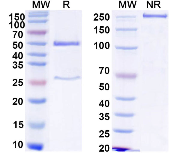 SDS-PAGE for Anti-HCV NS1/gp68/gp70/Envelope glycoprotein E2 Antibody (MAb24)