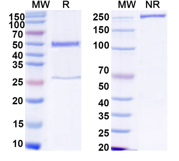 SDS-PAGE for Anti-HCV NS1/gp68/gp70/Envelope glycoprotein E2 Antibody (D03)