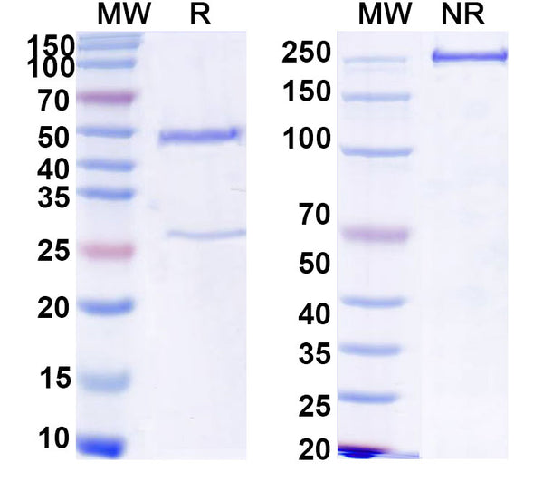 SDS-PAGE for Anti-HCV NS1/gp68/gp70/Envelope glycoprotein E2 Antibody (B11)