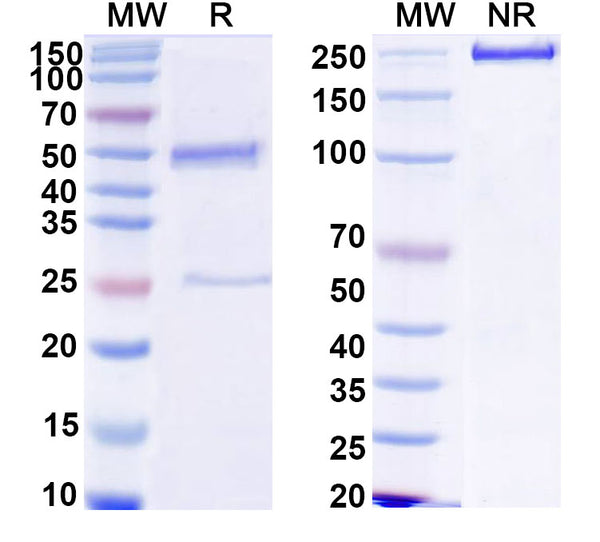 SDS-PAGE for Anti-HCV NS1/gp68/gp70/Envelope glycoprotein E2 Antibody (HMAb 503)