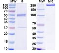 SDS-PAGE for Anti-HCV NS1/gp68/gp70/Envelope glycoprotein E2 Antibody (3/11#)