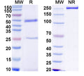 SDS-PAGE for Anti-HCV NS1/gp68/gp70/Envelope glycoprotein E2 Antibody (CM3.B6)