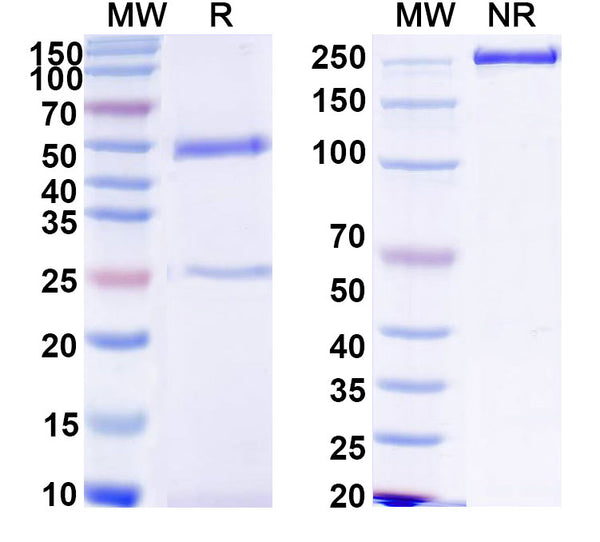 SDS-PAGE for Anti-HCV NS1/gp68/gp70/Envelope glycoprotein E2 Antibody (CM3.B6)