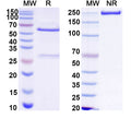 SDS-PAGE for Anti-HCV NS1/gp68/gp70/Envelope glycoprotein E2 Antibody (A12)