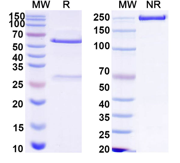 SDS-PAGE for Anti-HCV NS1/gp68/gp70/Envelope glycoprotein E2 Antibody (L3)