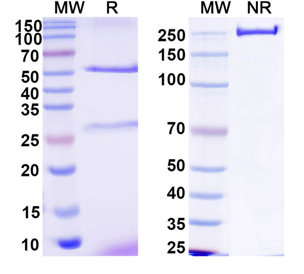 SDS-PAGE for Anti-HCV NS1/gp68/gp70/Envelope glycoprotein E2 Antibody (1:7#)