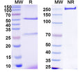 SDS-PAGE for Anti-HCV NS1/gp68/gp70/Envelope glycoprotein E2 Antibody (1:5#)