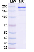 SDS-PAGE for Anti-HCV NS1/gp68/gp70/Envelope glycoprotein E2 Antibody (AP33).