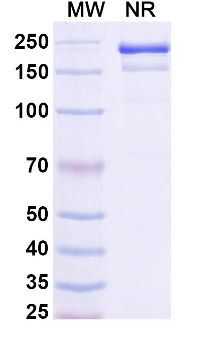 SDS-PAGE for Anti-HCV NS1/gp68/gp70/Envelope glycoprotein E2 Antibody (AP33).