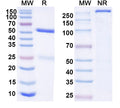 SDS-PAGE for Anti-HCV NS1/gp68/gp70/Envelope glycoprotein E2 Antibody (MRCT10.v362)