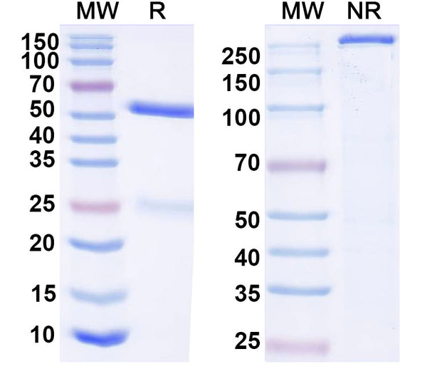SDS-PAGE for Anti-HCV NS1/gp68/gp70/Envelope glycoprotein E2 Antibody (MRCT10.v362)