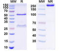 SDS-PAGE for Anti-HCV NS1/gp68/gp70/Envelope glycoprotein E2 Antibody (mAb#12)