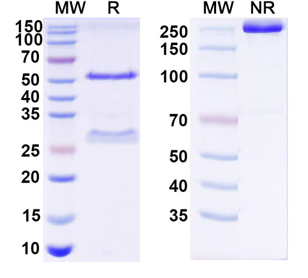 SDS-PAGE for Anti-HCV NS1/gp68/gp70/Envelope glycoprotein E2 Antibody (2A12)