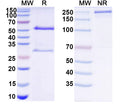 SDS-PAGE for Anti-HCV NS1/gp68/gp70/Envelope glycoprotein E2 Antibody (DAO5)