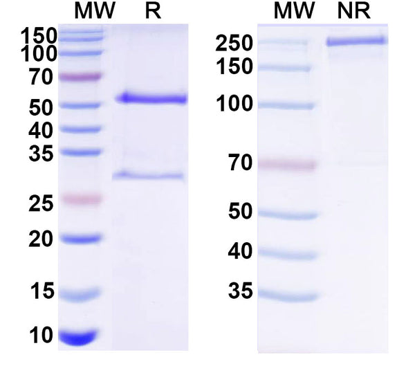 SDS-PAGE for Anti-HCV NS1/gp68/gp70/Envelope glycoprotein E2 Antibody (DAO5)