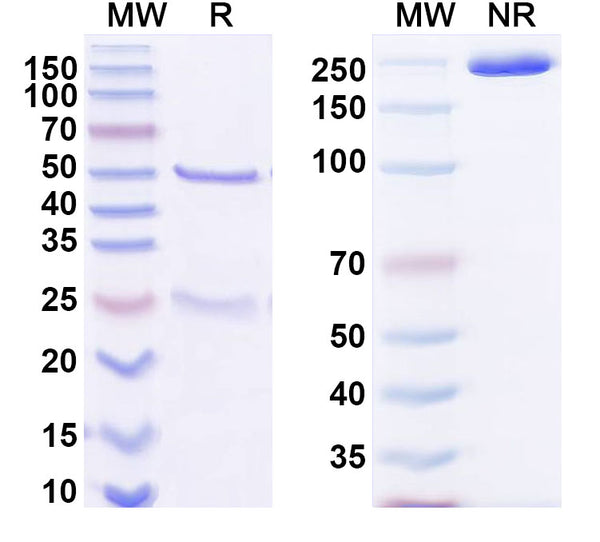 SDS-PAGE for Anti-HCV NS1/gp68/gp70/Envelope glycoprotein E2 Antibody (19B3)