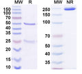 SDS-PAGE for Anti-HCV NS1/gp68/gp70/Envelope glycoprotein E2 Antibody (22D11)