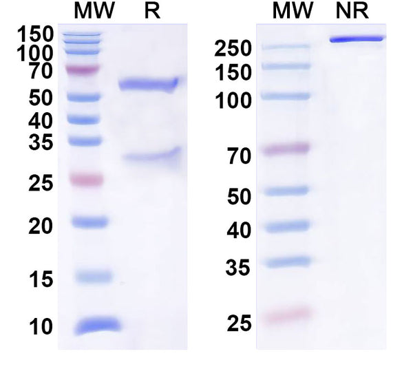 SDS-PAGE for Anti-HeV/NiV Glycoprotein G Antibody (1A050)