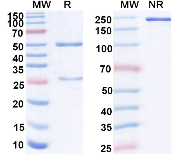 SDS-PAGE for Anti-Hendra virus/HeV Glycoprotein G Monoclonal Antibody (1A207)