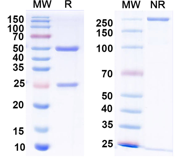 SDS-PAGE for Anti-HeV/NiV Glycoprotein G Antibody (HENV-21).