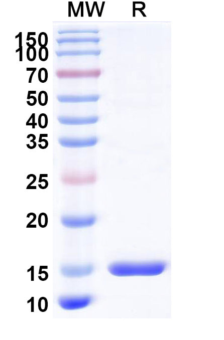 SDS-PAGE for Anti-Hepatitis C virus/HCV Genome polyprotein Nanobody (SAA1346)