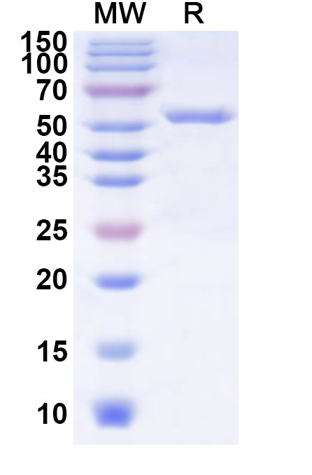 Recombinant SLEV NS3/Serine protease NS3 Protein, N-His