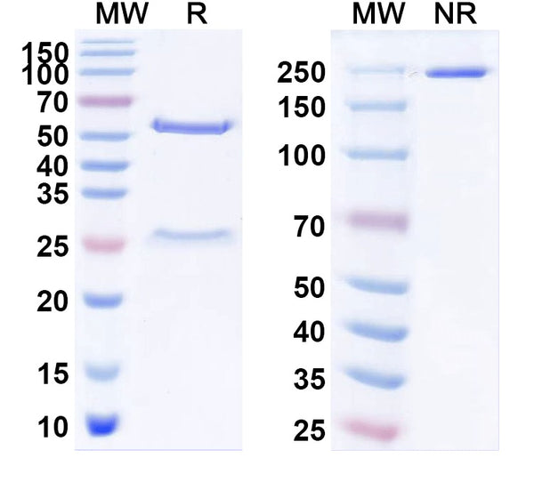 SDS-PAGE for Anti-Lagovirus Capsid protein VP60 antibody